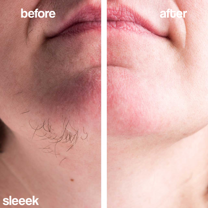 SLEEEK™ Hair Removal Cream