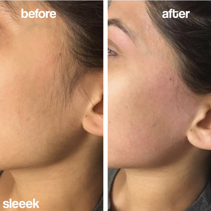 SLEEEK™ Hair Removal Cream
