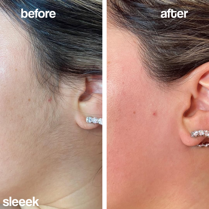 SLEEEK™ Hair Removal Cream