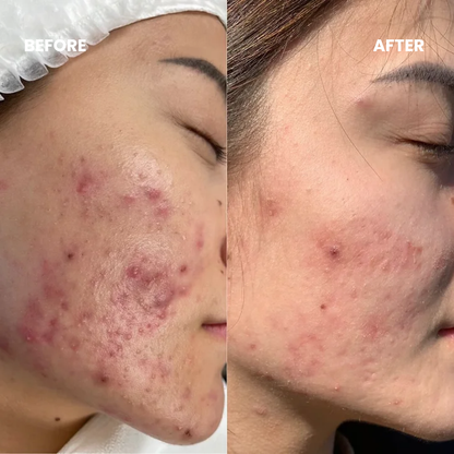 40:1 Myo & D-Chiro Inositol PCOS Support